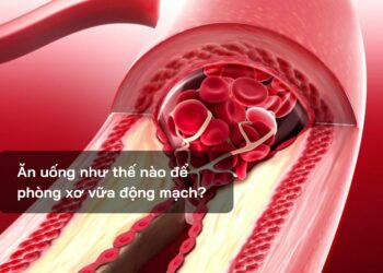 Ăn uống như thế nào để phòng xơ vữa động mạch?