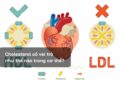 Cholesterol có vai trò như thế nào trong cơ thể?