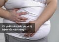 Có phải khi bị béo phì dễ bị bệnh sỏi mật không?