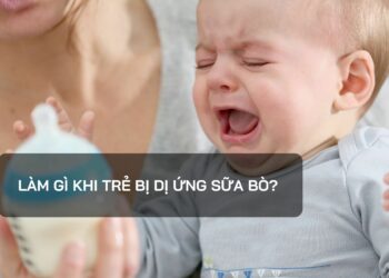 Làm gì khi trẻ bị dị ứng sữa bò?