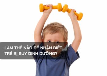 Làm thế nào để nhận biết trẻ bị SDD?