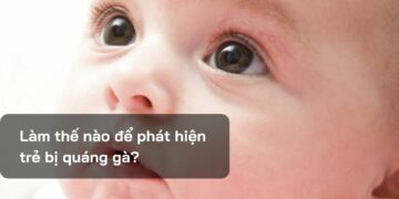 Làm thế nào để phát hiện trẻ bị quáng gà?