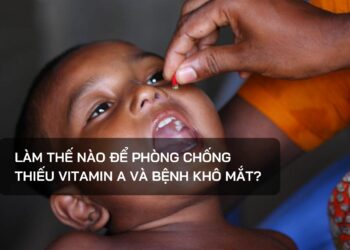 Làm thế nào để phòng chống thiếu vitamin A và bệnh khô mắt?