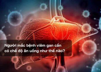 Người mắc bệnh viêm gan cần có chế độ ăn uống như thế nào?
