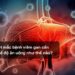 Người mắc bệnh viêm gan cần có chế độ ăn uống như thế nào?