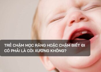 Trẻ chậm mọc răng hoặc chậm biết đi có phải là còi xương không?