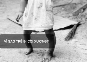 Vì sao trẻ bị còi xương?