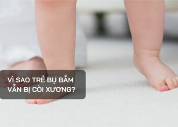 Vì sao trẻ bụ bẫm vẫn bị còi xương?